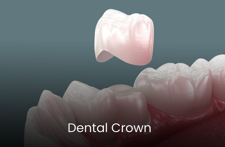 Dental Crown