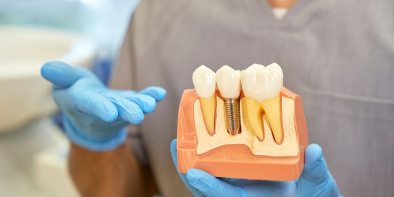 Top-7-Reasons-Why-Dental-Implants-Are-the-Best-Solution-for-Missing-Teeth