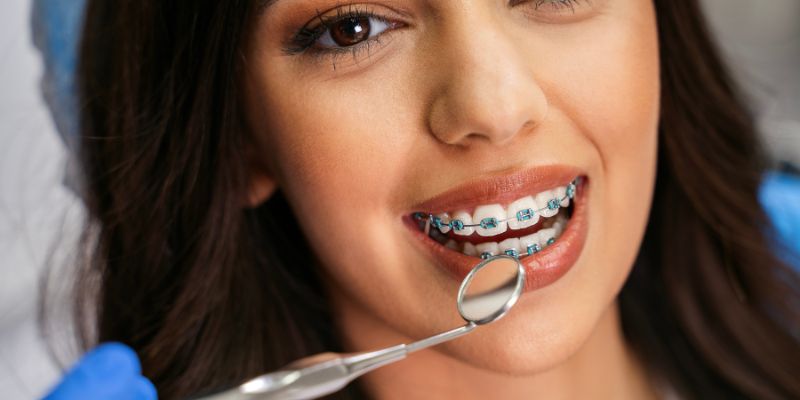 Braces-Treatment